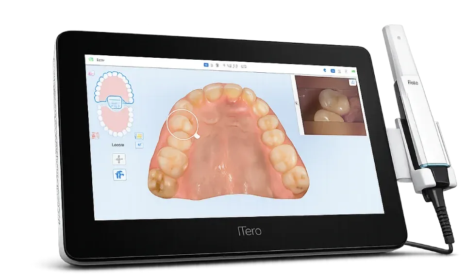 Scanner intraoral iTero Lumina exibindo arcada dentária escaneada em 3D