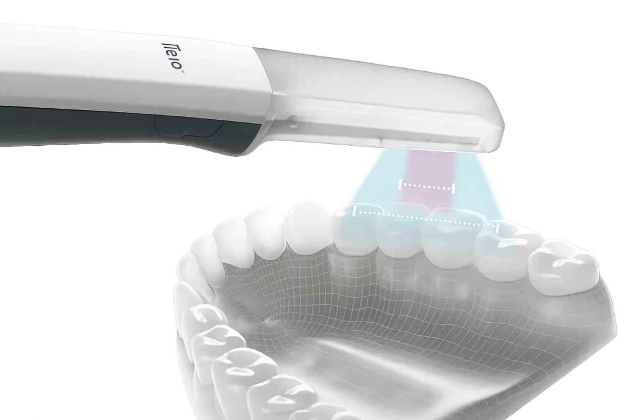 Comparação do campo de visão ampliado do scanner iTero Lumina sobre uma arcada dentária